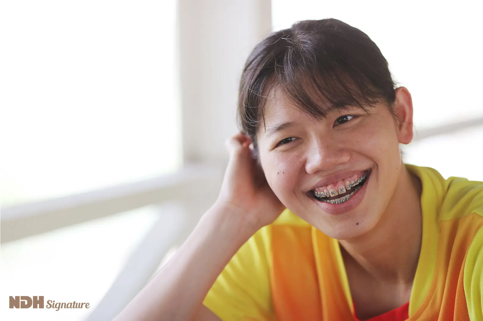 Ánh Viên tựa tay lên má, cười tươi để lộ niềng răng